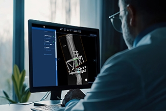 Limb Lengthening and Deformity Correction: A Practical Overview