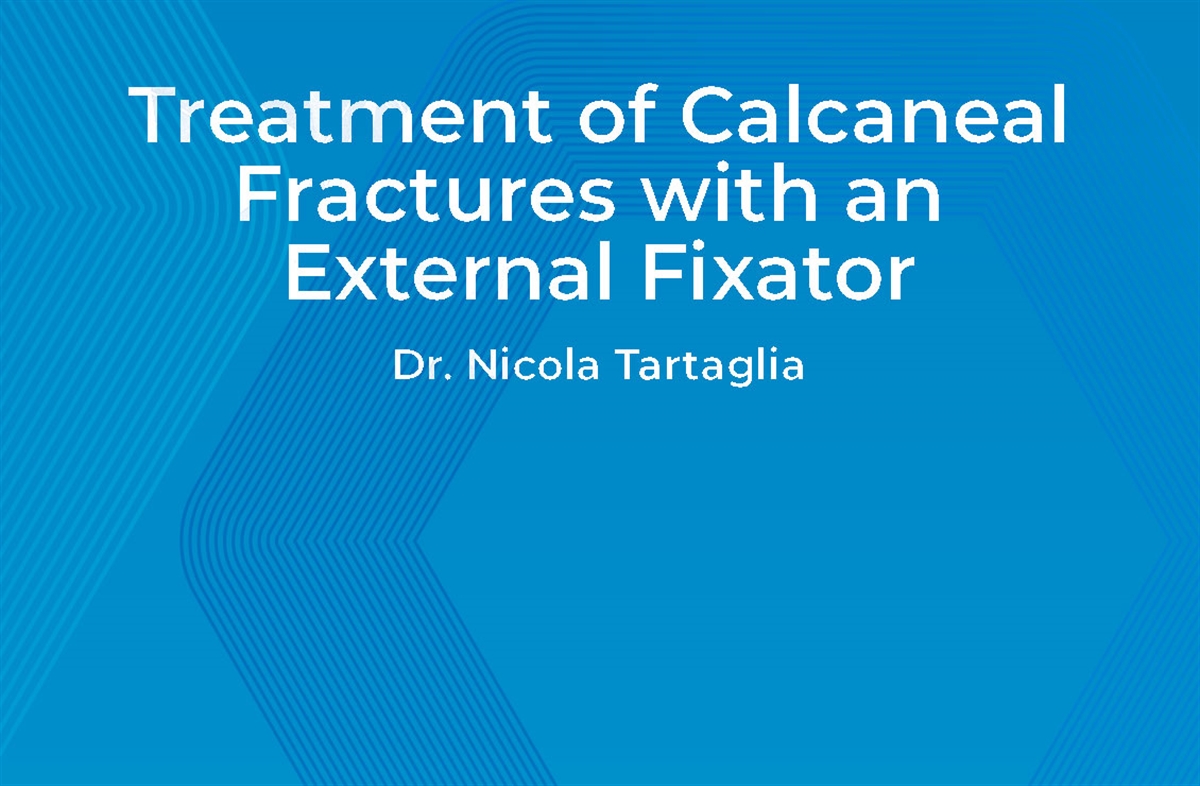 Treatment of calcaneal fractures with external fixator